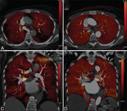 Figure 10 (A-D)