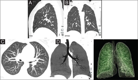 Figure 2 (A-D)