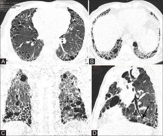 Figure 6 (A-D)