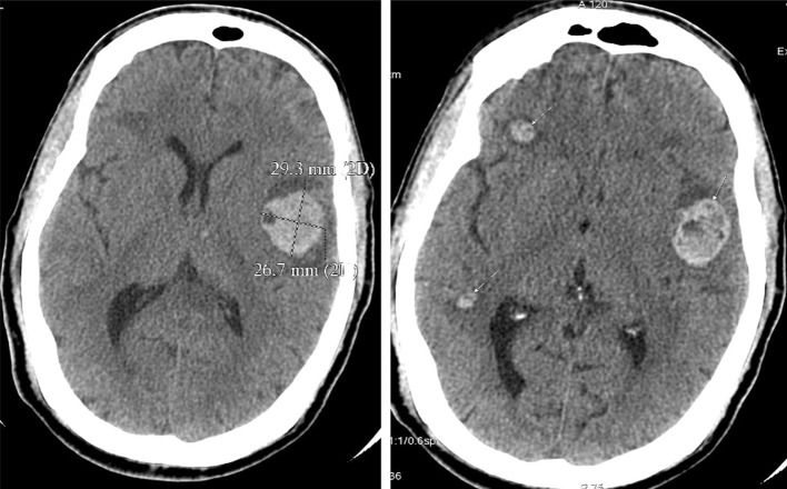 Fig. 2