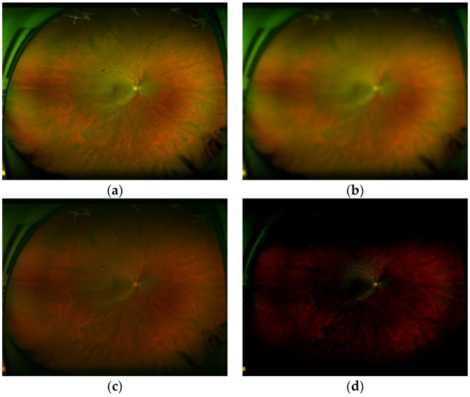 Figure 15