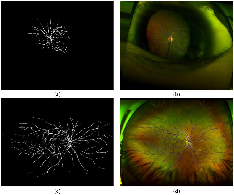 Figure 14