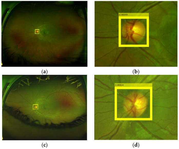 Figure 11