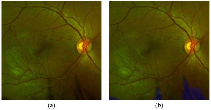 Figure 13