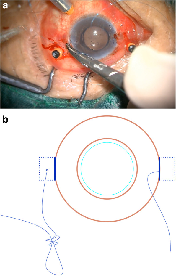 Fig. 5