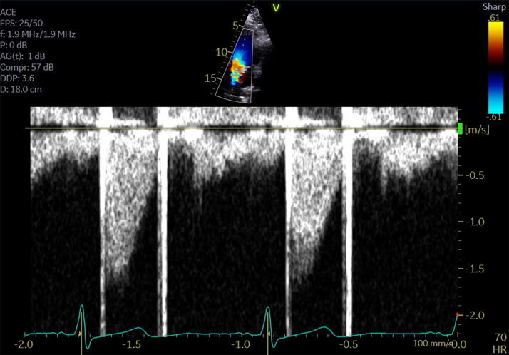 Figure 1