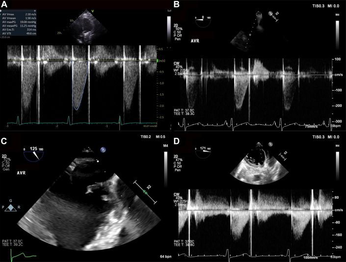 Figure 2