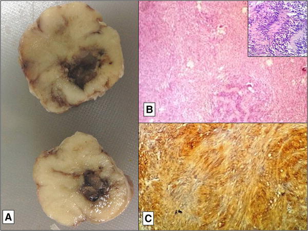 Fig. 2