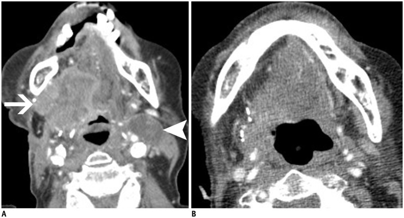 Fig. 9