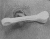 237