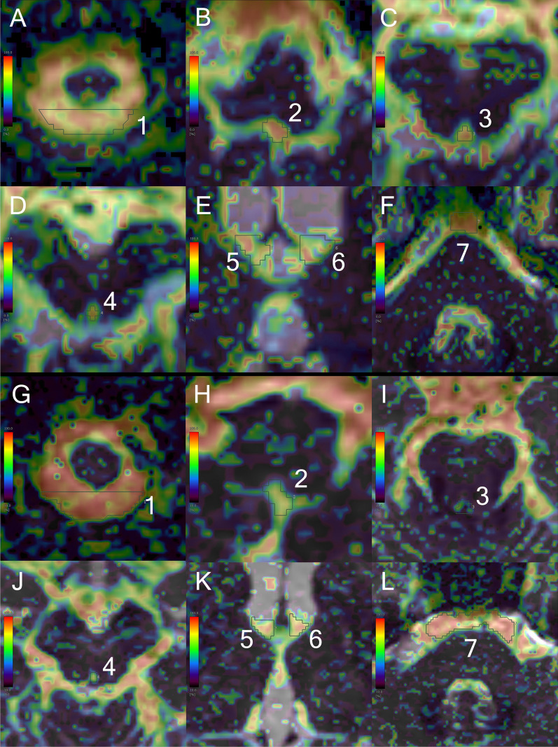 Fig. 3