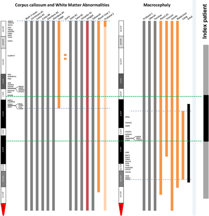 FIGURE 11