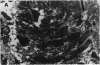 197
