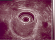 Fig. 1