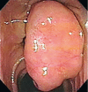 Fig. 2