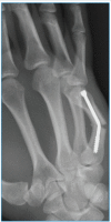 Figure 12.