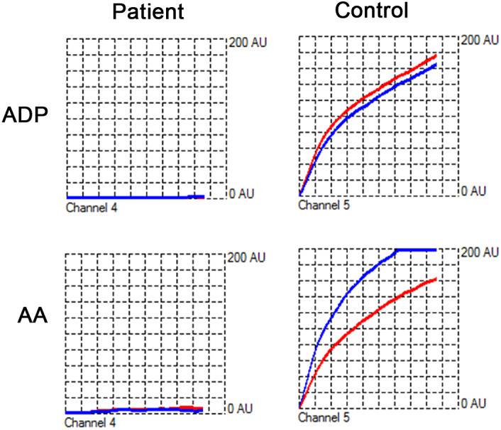 FIGURE 1