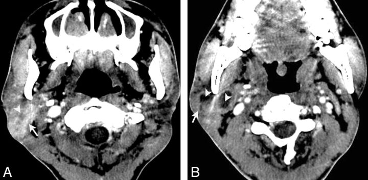 Fig 5.