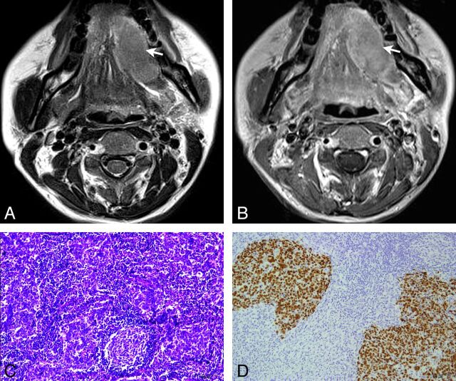 Fig 3.