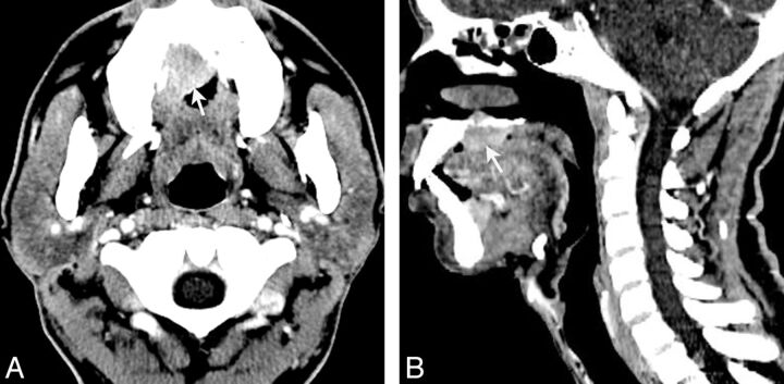 Fig 4.