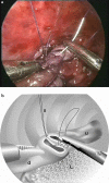 Fig. 1