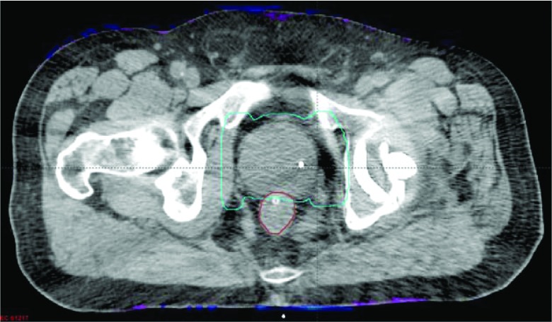 Figure 10