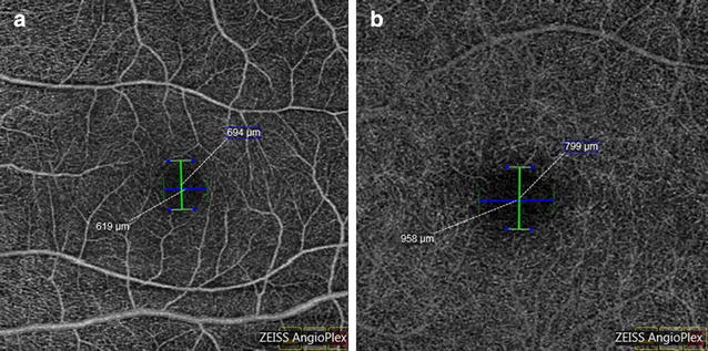 Fig. 1