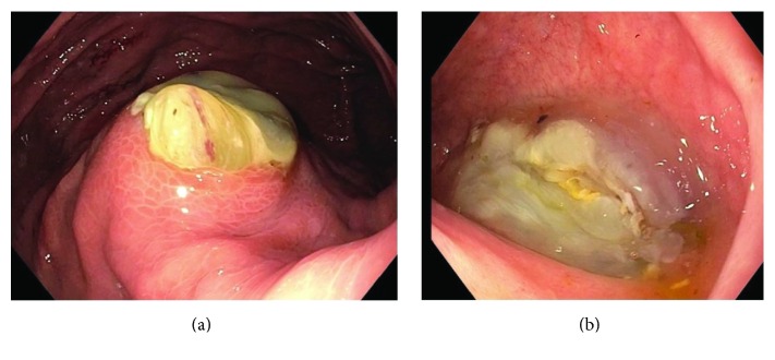 Figure 14