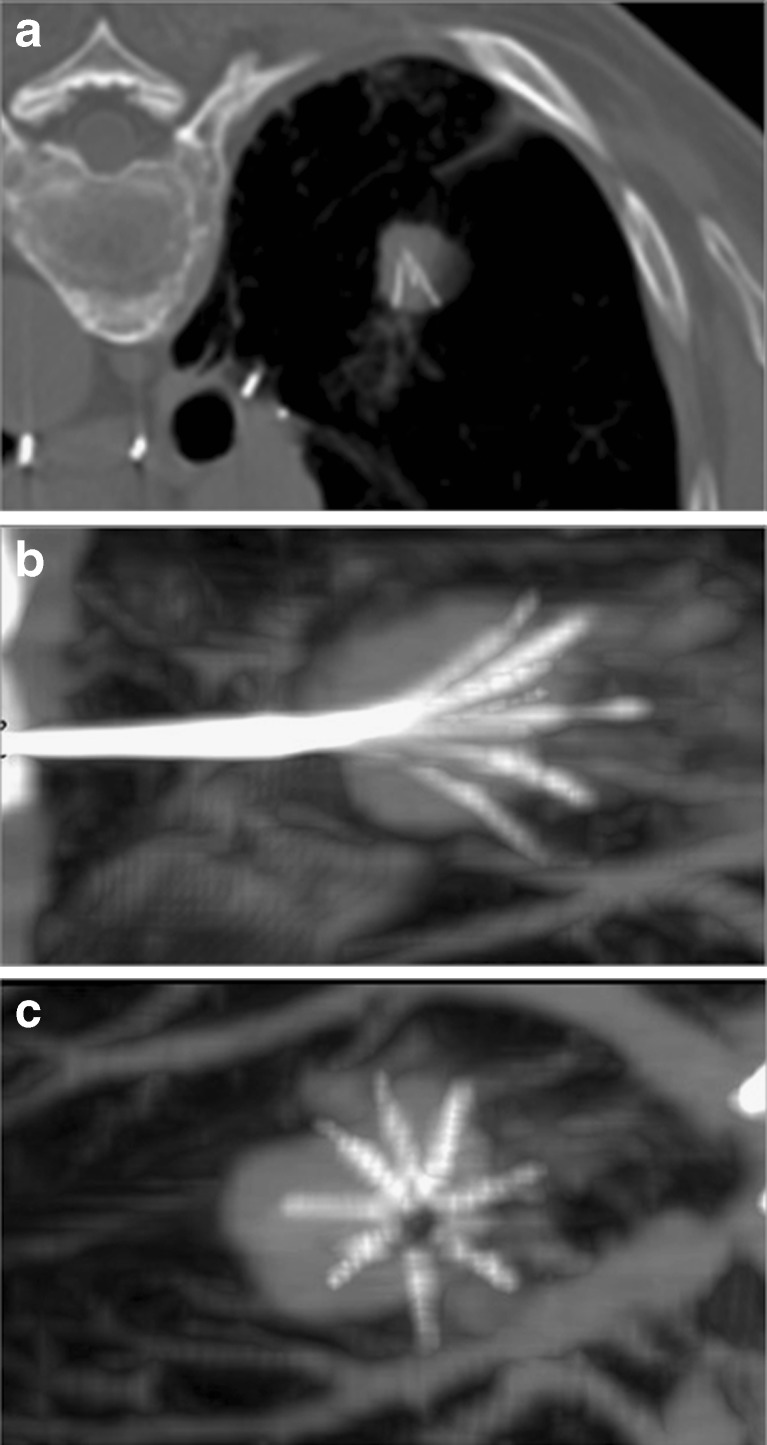 Fig. 1