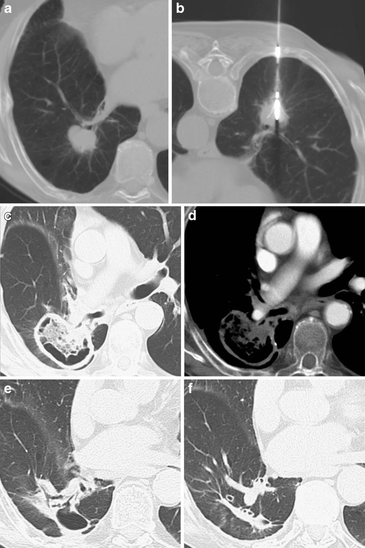 Fig. 6