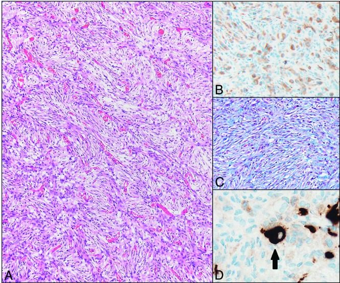 Fig 3.