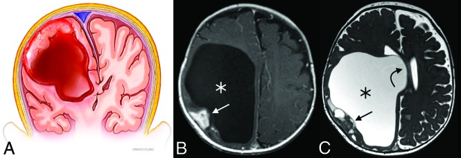 Fig 4.