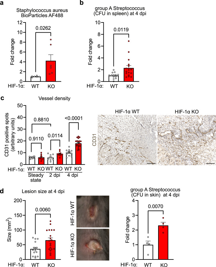 NK cells in hypoxic skin mediate a trade-off between wound healing and ...