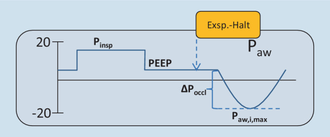 graphic file with name 63_2021_823_Fig11_HTML.jpg