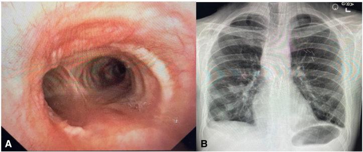 Figure 2