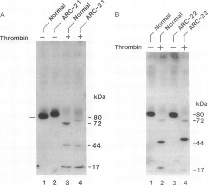 graphic file with name pnas01085-0163-a.jpg