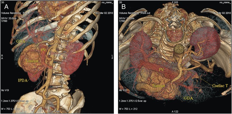 Figure 2: