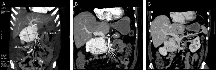 Figure 1: