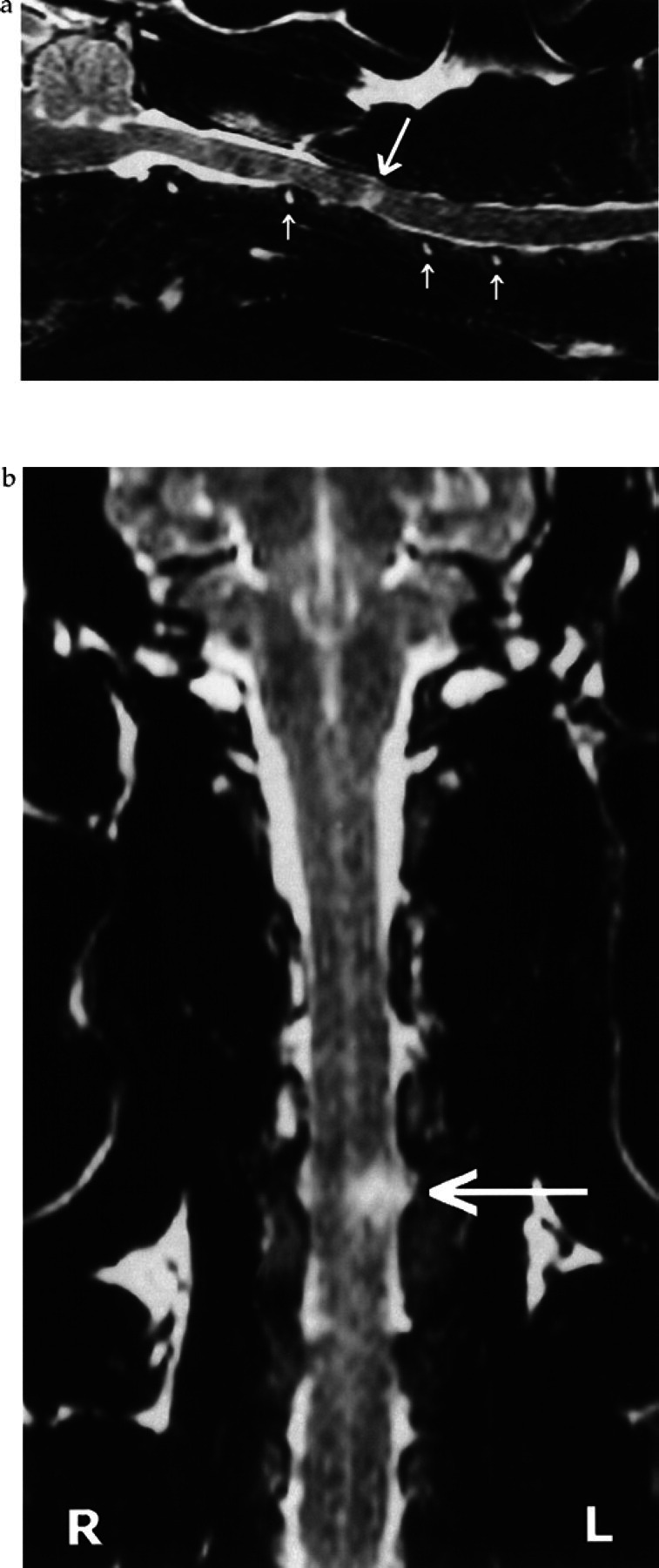 Fig 2.