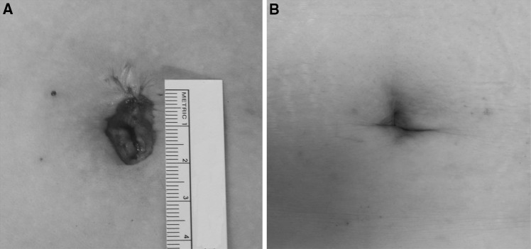 Fig. 4