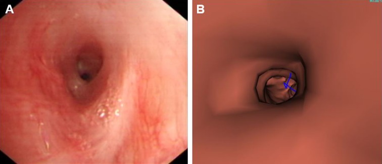 Fig. 2