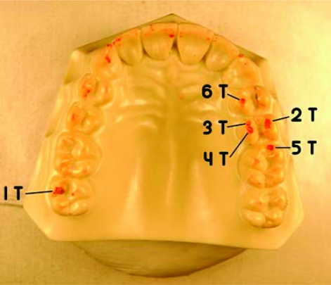 Fig. (4)