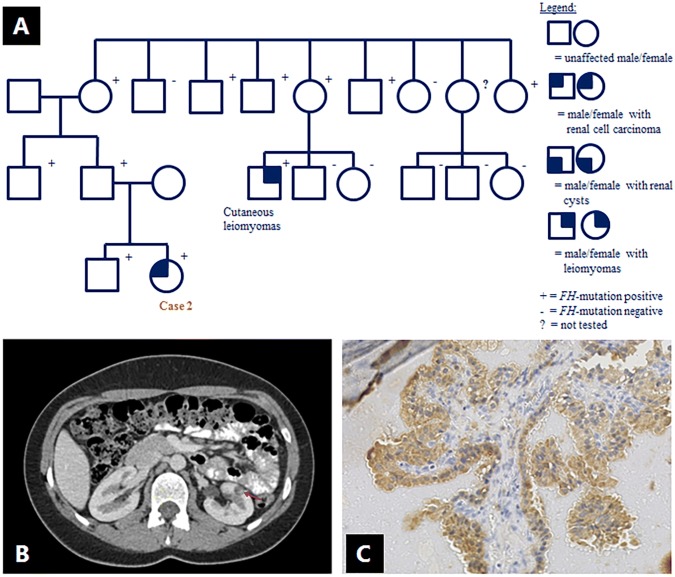 Fig. 2