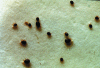 Figure 3B