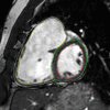 Figure 2a: