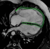 Figure 1b: