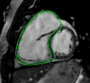 Figure 1a: