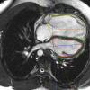 Figure 2b: