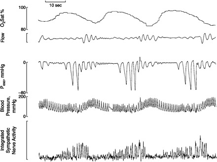 Fig. 12.