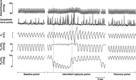 Fig. 14.